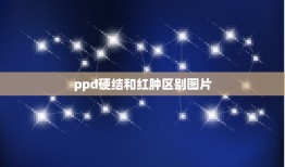 ppd硬结和红肿区别图片，结核菌素试验是看红肿部位多大还是硬结部位